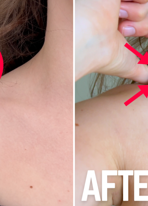 How to Shorten Shirt Straps Without Sewing